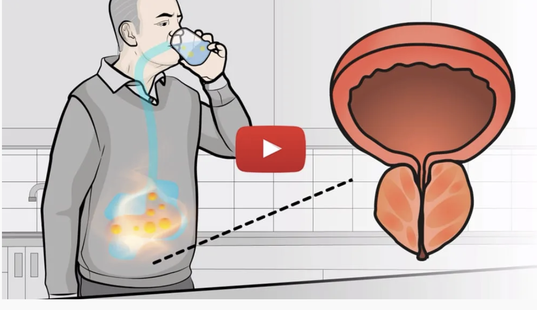Doctor Prostate Video