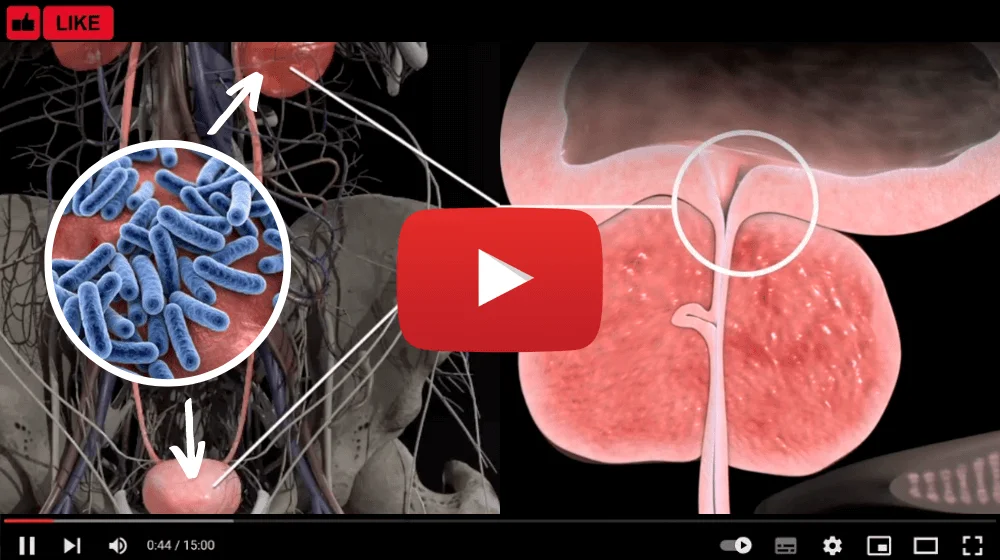 Prostate Video